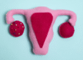 What More Women Should Know About Hormonal Health and Fibroids 8 What More Women Should Know About Hormonal Health and Fibroids