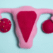 What More Women Should Know About Hormonal Health and Fibroids 7 What More Women Should Know About Hormonal Health and Fibroids