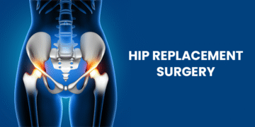 hip replacement surgery