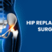 hip replacement surgery