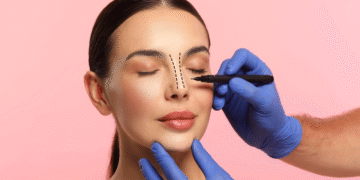 Questions Patients Often Ask Before Rhinoplasty