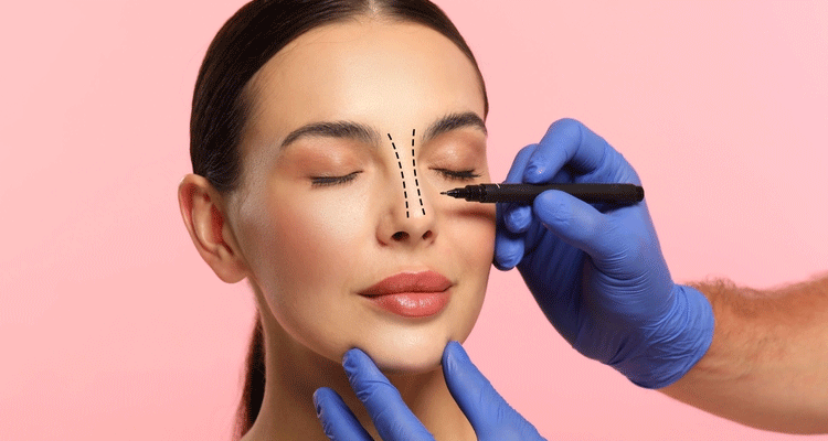 Questions Patients Often Ask Before Rhinoplasty