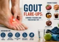 Gout Flare-Ups: Common Triggers and Prevention Tips 48 Gout