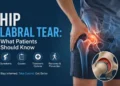 Hip Labral Tear: What Patients Should Know 10 Hip Labral Tear